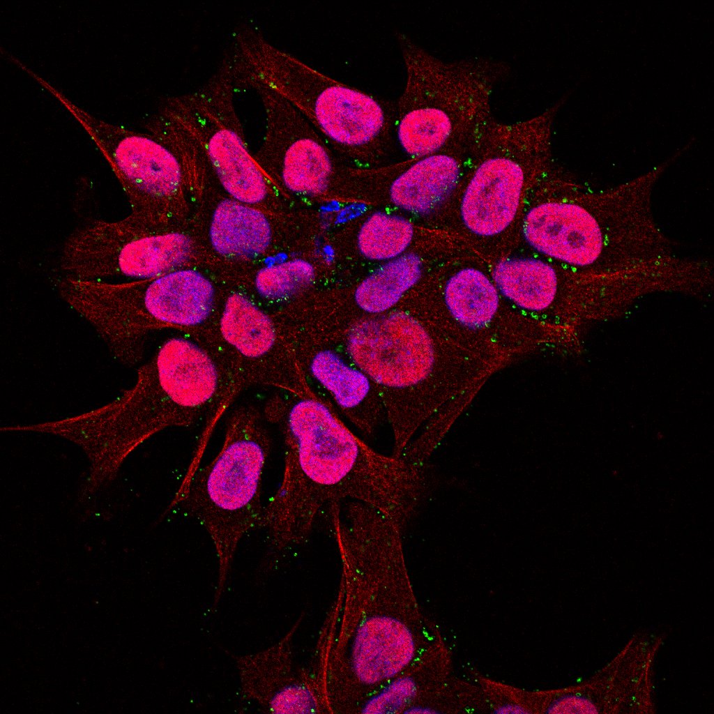 Primeros ramos de primavera in vitro